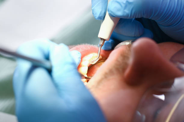 Best Teeth Whitening  in Montecito, CA